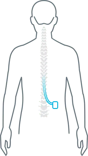 HFX-Human-Diagram Human Diagram SCS