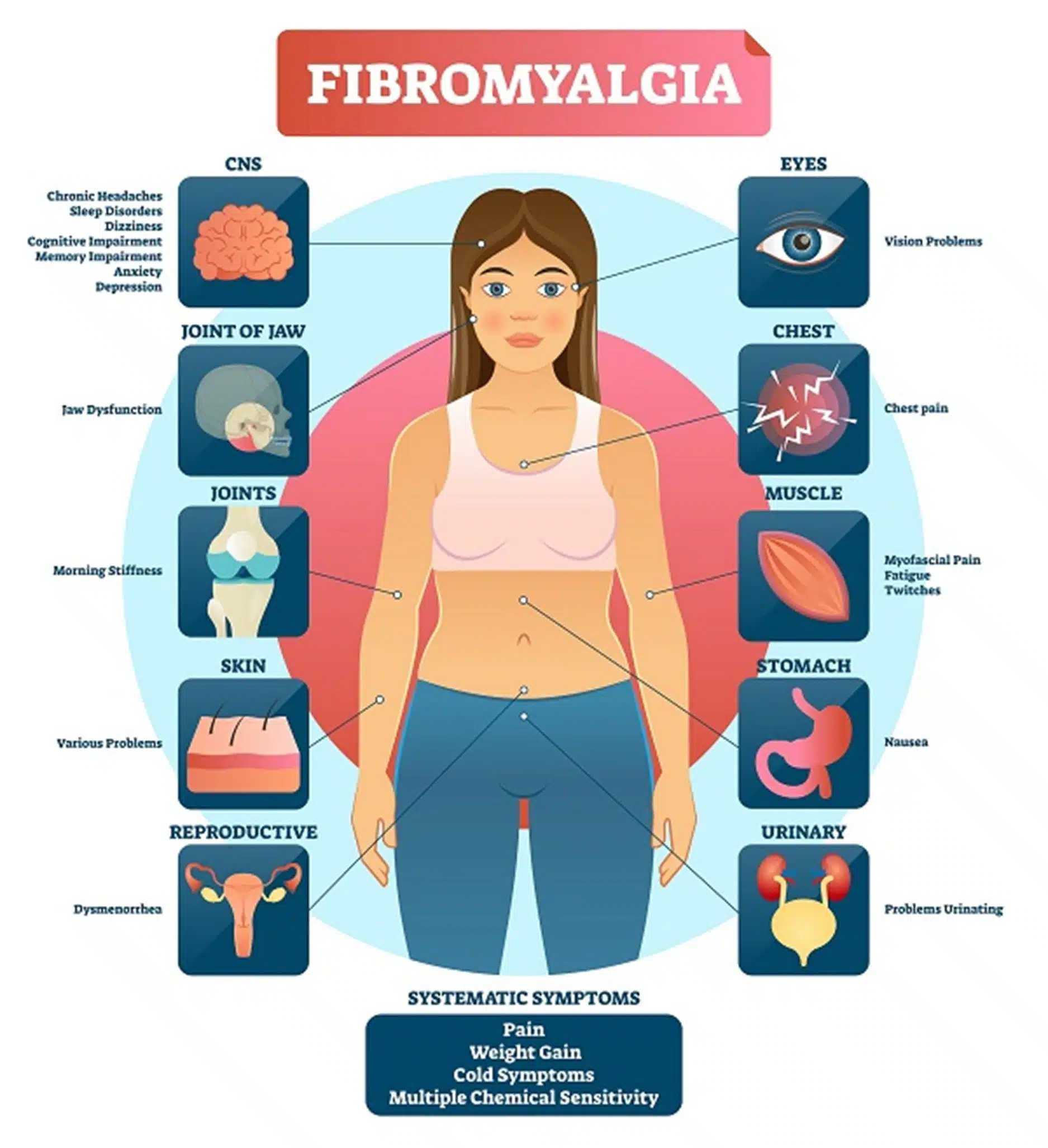 Fibromyalgia Fibromyalgia illustration