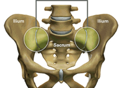 Sacroiliac Joint illustration