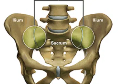 Sacroiliac Joint illustration